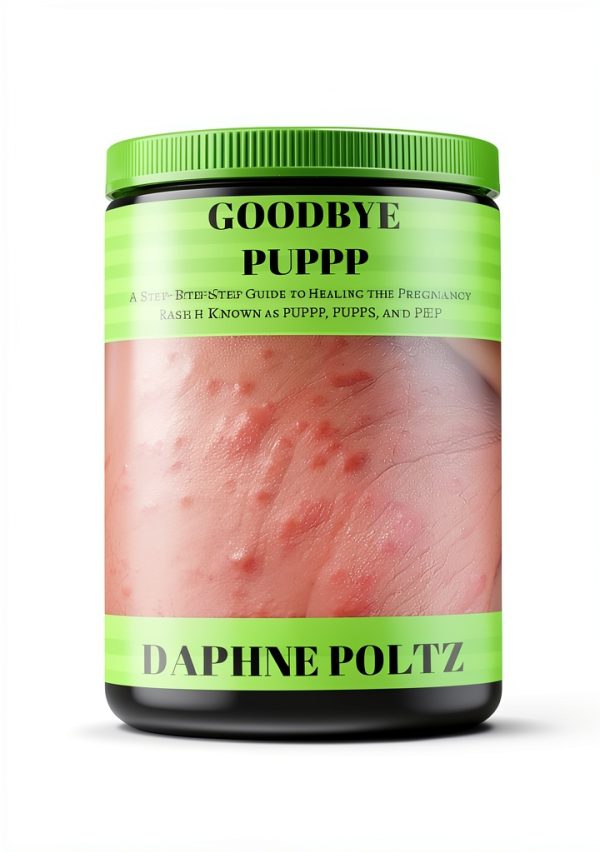 Kindle eBook Skin Ailments Health Guide English Language-0