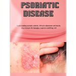 Kindle eBook Skin Ailments Rheumatic Diseases English-0