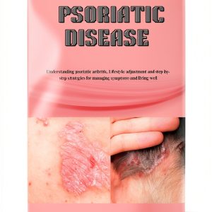 Kindle eBook Skin Ailments Rheumatic Diseases English-0